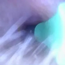 Visual Ear Wax Cleaner with Camera Safe Earwax Removal Endoscope with 5M Camera Luminous Otoscope Ear Cleaning Tools Ear Care